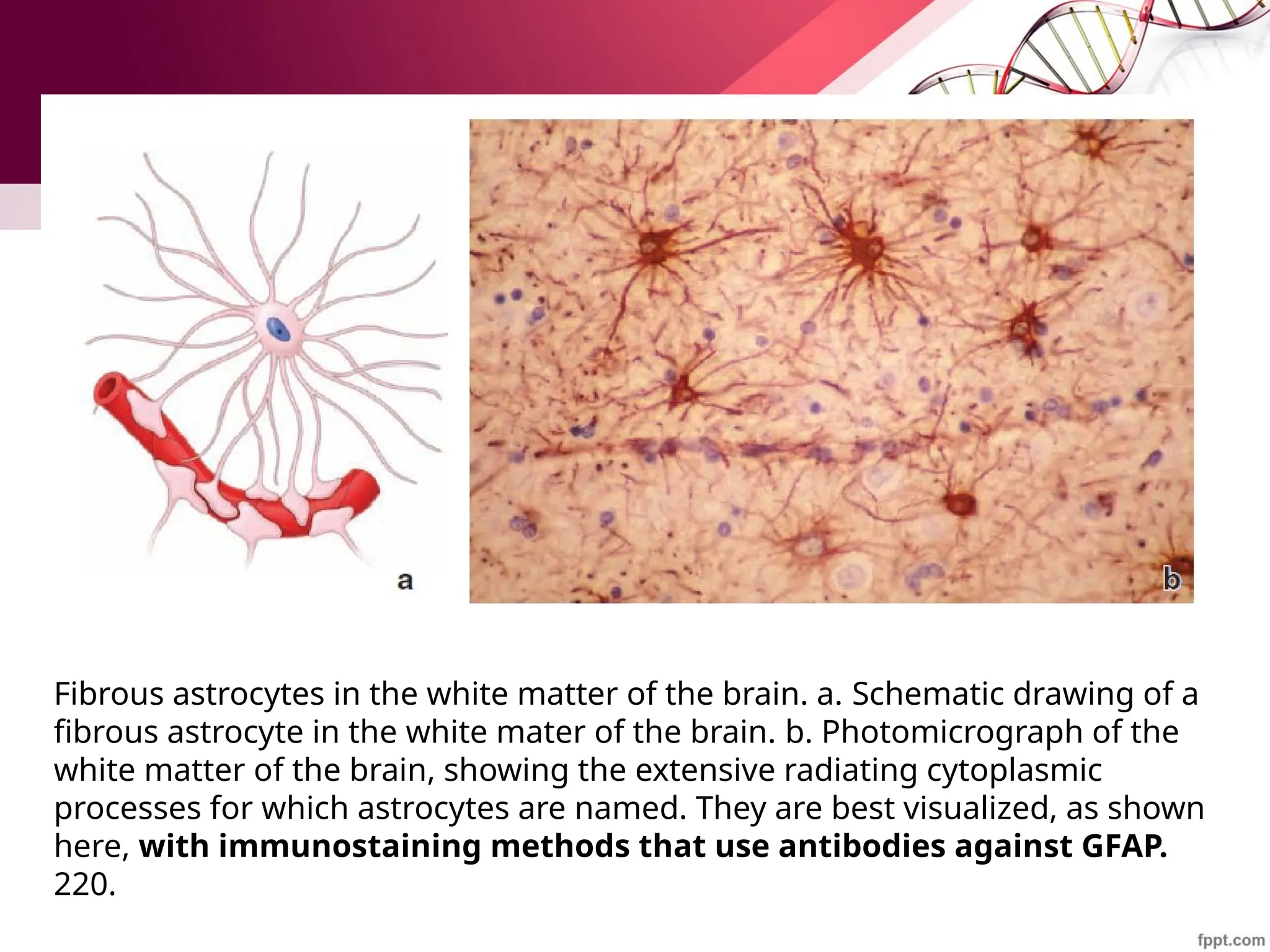 Fibrous astrocytes in the white matter of the brain. a. Schematic drawing of a
fibrous astrocyte in the white mater of the brain. b. Photomicrograph of the
white matter of the brain, showing the extensive radiating cytoplasmic
processes for which astrocytes are named. They are best visualized, as shown
here, with immunostaining methods that use antibodies against GFAP.
220.
 