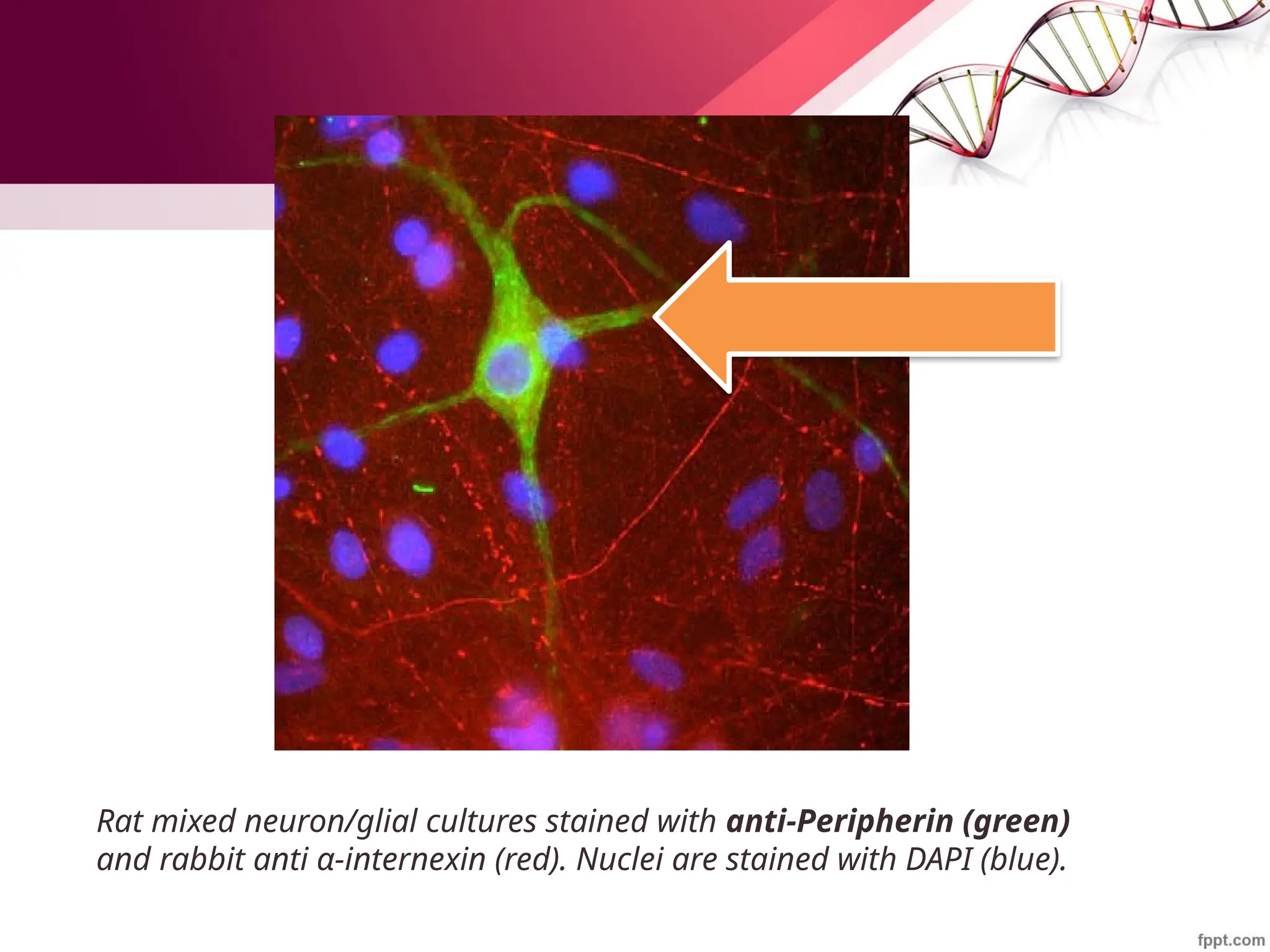 Rat mixed neuron/glial cultures stained with anti-Peripherin (green)
and rabbit anti α-internexin (red). Nuclei are stained with DAPI (blue).
 