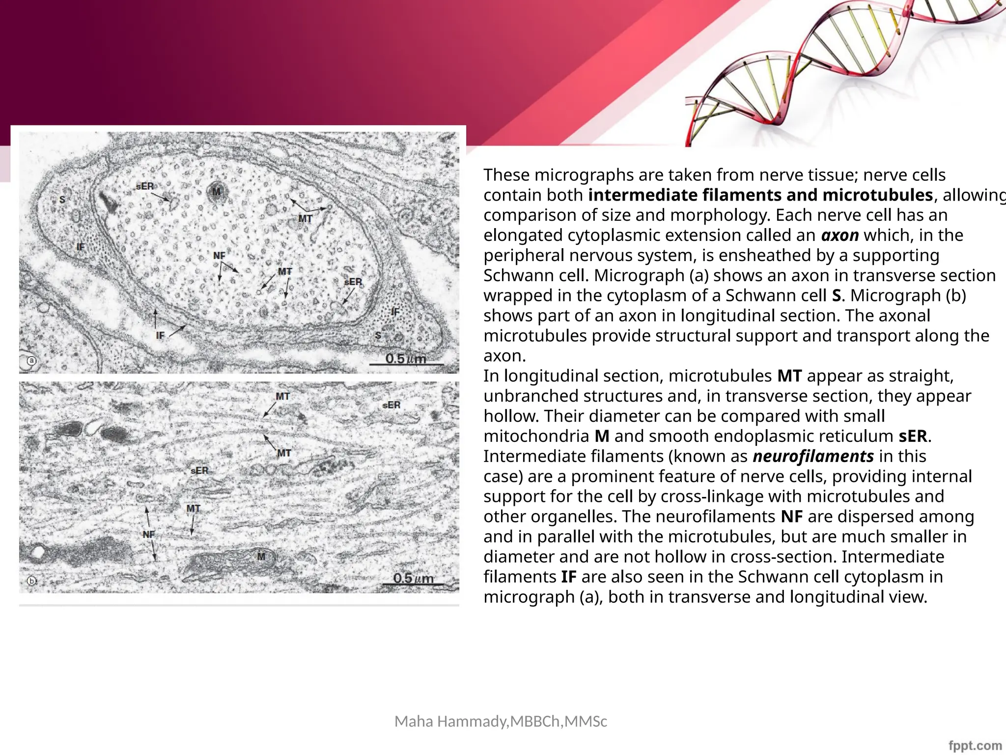 Maha Hammady,MBBCh,MMSc
These micrographs are taken from nerve tissue; nerve cells
contain both intermediate filaments and microtubules, allowing
comparison of size and morphology. Each nerve cell has an
elongated cytoplasmic extension called an axon which, in the
peripheral nervous system, is ensheathed by a supporting
Schwann cell. Micrograph (a) shows an axon in transverse section
wrapped in the cytoplasm of a Schwann cell S. Micrograph (b)
shows part of an axon in longitudinal section. The axonal
microtubules provide structural support and transport along the
axon.
In longitudinal section, microtubules MT appear as straight,
unbranched structures and, in transverse section, they appear
hollow. Their diameter can be compared with small
mitochondria M and smooth endoplasmic reticulum sER.
Intermediate filaments (known as neurofilaments in this
case) are a prominent feature of nerve cells, providing internal
support for the cell by cross-linkage with microtubules and
other organelles. The neurofilaments NF are dispersed among
and in parallel with the microtubules, but are much smaller in
diameter and are not hollow in cross-section. Intermediate
filaments IF are also seen in the Schwann cell cytoplasm in
micrograph (a), both in transverse and longitudinal view.
 