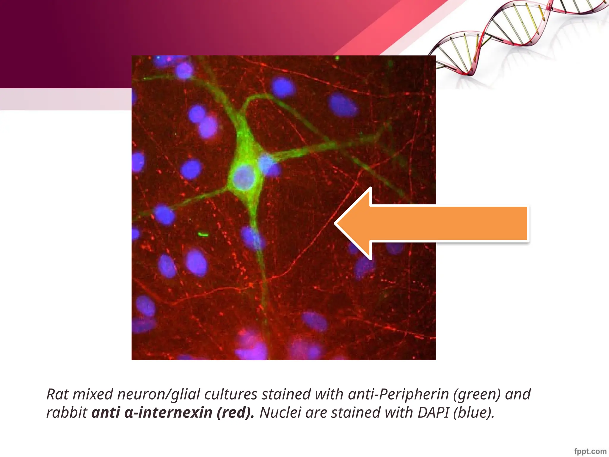 Rat mixed neuron/glial cultures stained with anti-Peripherin (green) and
rabbit anti α-internexin (red). Nuclei are stained with DAPI (blue).
 