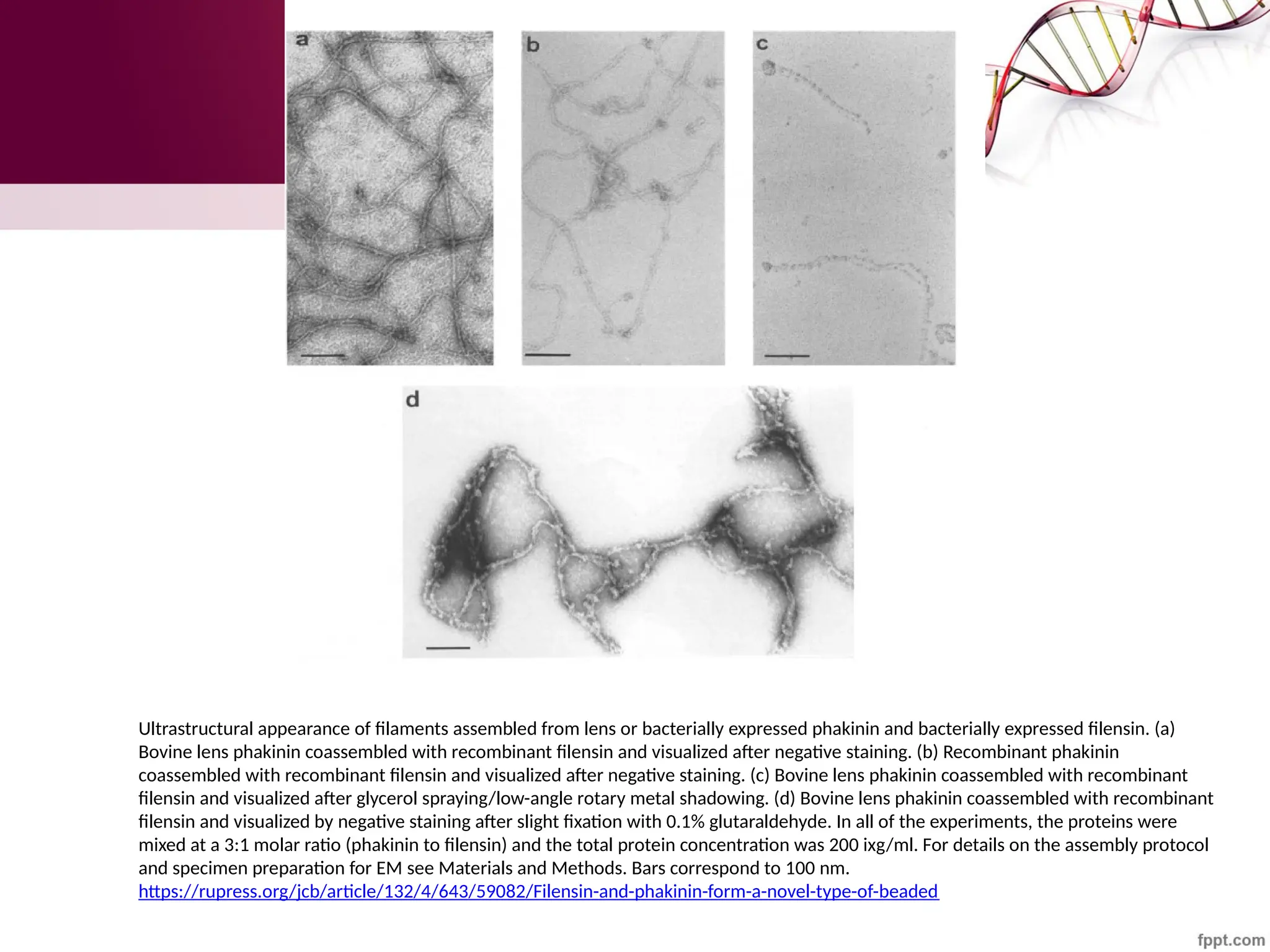 Ultrastructural appearance of filaments assembled from lens or bacterially expressed phakinin and bacterially expressed filensin. (a)
Bovine lens phakinin coassembled with recombinant filensin and visualized after negative staining. (b) Recombinant phakinin
coassembled with recombinant filensin and visualized after negative staining. (c) Bovine lens phakinin coassembled with recombinant
filensin and visualized after glycerol spraying/low-angle rotary metal shadowing. (d) Bovine lens phakinin coassembled with recombinant
filensin and visualized by negative staining after slight fixation with 0.1% glutaraldehyde. In all of the experiments, the proteins were
mixed at a 3:1 molar ratio (phakinin to filensin) and the total protein concentration was 200 ixg/ml. For details on the assembly protocol
and specimen preparation for EM see Materials and Methods. Bars correspond to 100 nm.
https://rupress.org/jcb/article/132/4/643/59082/Filensin-and-phakinin-form-a-novel-type-of-beaded
 