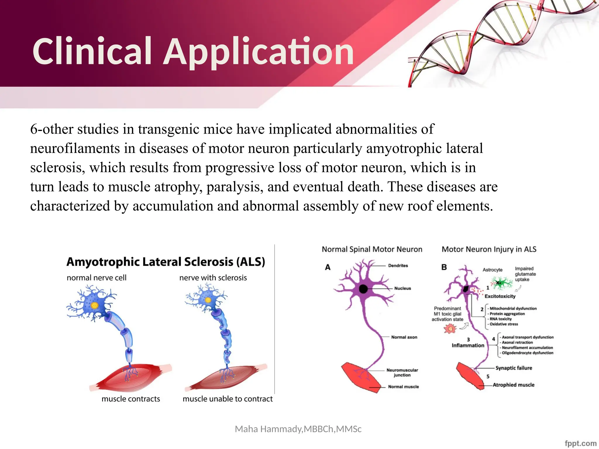 Clinical Application
6-other studies in transgenic mice have implicated abnormalities of
neurofilaments in diseases of motor neuron particularly amyotrophic lateral
sclerosis, which results from progressive loss of motor neuron, which is in
turn leads to muscle atrophy, paralysis, and eventual death. These diseases are
characterized by accumulation and abnormal assembly of new roof elements.
Maha Hammady,MBBCh,MMSc
 