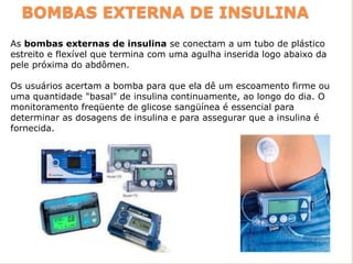 BOMBAS EXTERNA DE INSULINA
As bombas externas de insulina se conectam a um tubo de plástico
estreito e flexível que termina com uma agulha inserida logo abaixo da
pele próxima do abdômen.
Os usuários acertam a bomba para que ela dê um escoamento firme ou
uma quantidade "basal" de insulina continuamente, ao longo do dia. O
monitoramento freqüente de glicose sangüínea é essencial para
determinar as dosagens de insulina e para assegurar que a insulina é
fornecida.
 