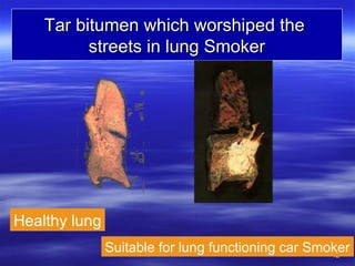 1212
Tar bitumen which worshiped theTar bitumen which worshiped the
streets in lung Smokerstreets in lung Smoker
Healthy lung
Suitable for lung functioning car Smoker
 