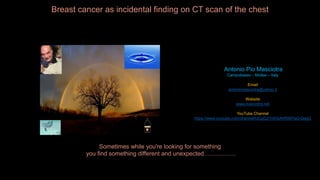 Breast cancer as incidental finding on CT scan of the chest

Antonio Pio Masciotra
Campobasso – Molise – Italy
Email
antoniomasciotra@yahoo.it
Website
www.masciotra.net
YouTube Channel
https://www.youtube.com/channel/UCgCj21nKGAhR997Ia3-QegQ

Sometimes while you're looking for something
you find something different and unexpected…………….

 