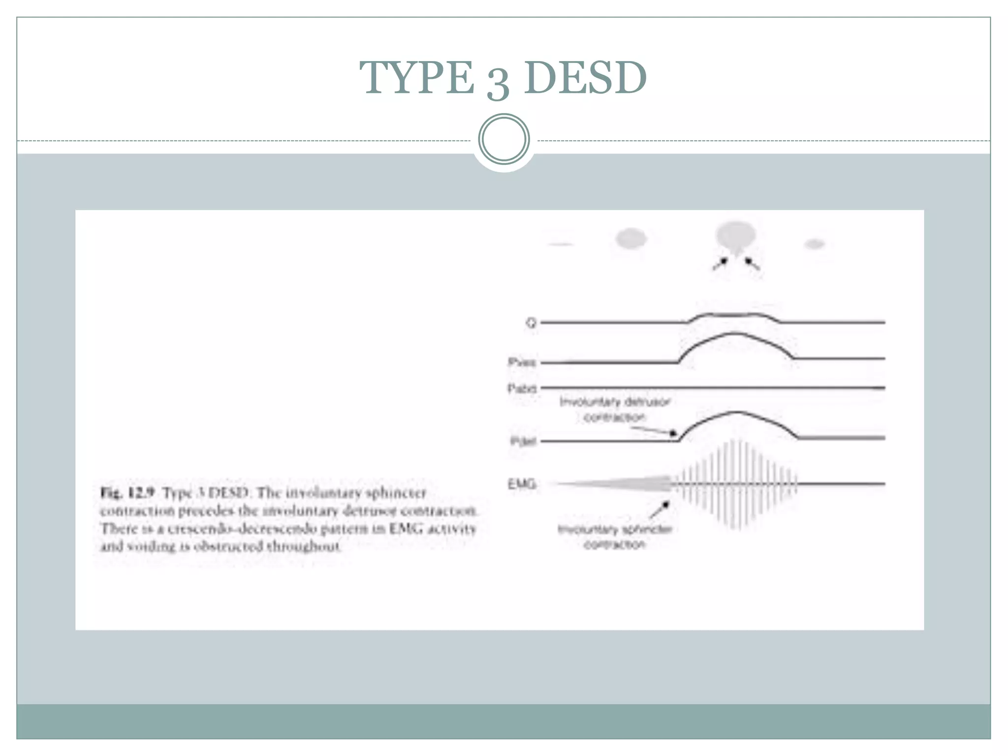 TYPE 3 DESD 
 