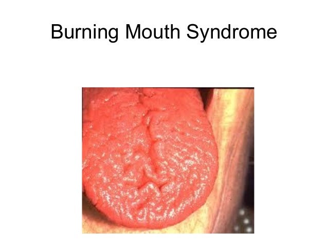 Difficulty Eating Solid Foods Difficulty Eating Solid Foods
