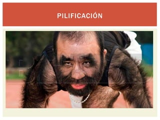 PILIFICACIÓN
 