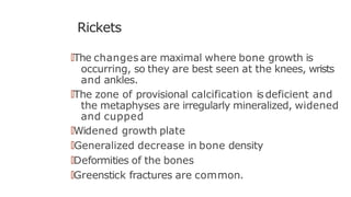 Rickets
🠶The changes are maximal where bone growth is
occurring, so they are best seen at the knees, wrists
and ankles.
🠶The zone of provisional calcification isdeficient and
the metaphyses are irregularly mineralized, widened
and cupped
🠶Widened growth plate
🠶Generalized decrease in bone density
🠶Deformities of the bones
🠶Greenstick fractures are common.
 