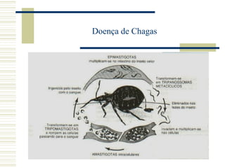 Doença de Chagas
 