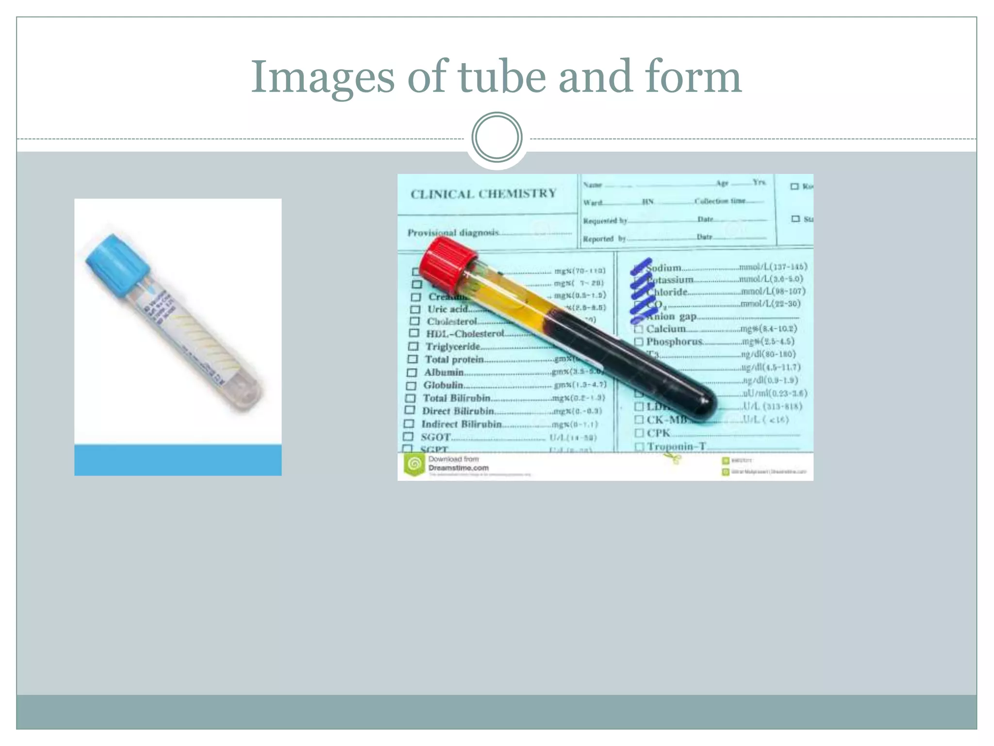 Images of tube and form
 
