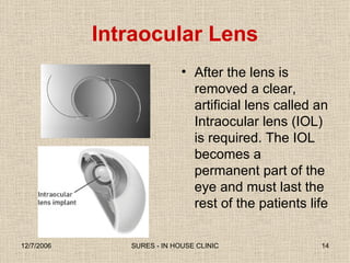 Intraocular Lens After the lens is removed a clear, artificial lens called an Intraocular lens (IOL) is required. The IOL becomes a permanent part of the eye and must last the rest of the patients life 