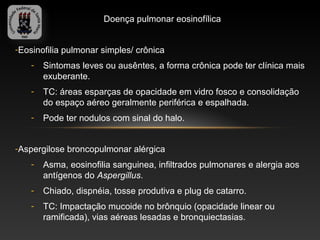 Doença pulmonar eosinofílica


-Eosinofilia pulmonar simples/ crônica
    -   Sintomas leves ou ausêntes, a forma crônica pode ter clínica mais
        exuberante.
    -   TC: áreas esparças de opacidade em vidro fosco e consolidação
        do espaço aéreo geralmente periférica e espalhada.
    -   Pode ter nodulos com sinal do halo.


-Aspergilose broncopulmonar alérgica
    -   Asma, eosinofilia sanguinea, infiltrados pulmonares e alergia aos
        antígenos do Aspergillus.
    -   Chiado, dispnéia, tosse produtiva e plug de catarro.
    -   TC: Impactação mucoide no brônquio (opacidade linear ou
        ramificada), vias aéreas lesadas e bronquiectasias.
 