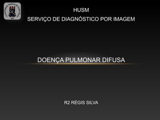 HUSM
SERVIÇO DE DIAGNÓSTICO POR IMAGEM




   DOENÇA PULMONAR DIFUSA




           R2 RÉGIS SILVA
 