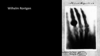 Wilhelm Rontgen
 