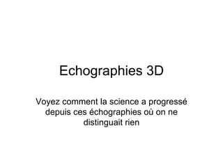 Echographies 3D Voyez comment la science a progressé depuis ces échographies où on ne distinguait rien 
