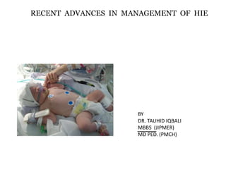 RECENT ADVANCES IN MANAGEMENT OF HIE
BY
DR. TAUHID IQBALI
MBBS (JIPMER)
MD PED. (PMCH)
 