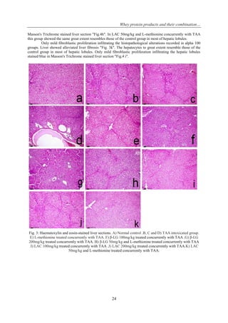 Whey protein products and their combination…
24
Masson's Trichrome stained liver section "Fig.4h". In LAC 50mg/kg and L-methionine concurrently with TAA
this group showed the same great extent resembles those of the control group in most of hepatic lobules.
Only mild fibroblastic proliferation infiltrating the histopathological alterations recorded in alpha 100
groups. Liver showed alleviated liver fibrosis "Fig. 3k". The hepatocytes to great extent resemble those of the
control group in most of hepatic lobules. Only mild fibroblastic proliferation infiltrating the hepatic lobules
stained blue in Masson's Trichrome stained liver section "Fig.4 i".
Fig. 3: Haematoxylin and eosin-stained liver sections. A) Normal control .B, C and D) TAA intoxicated group.
E) L-methionine treated concurrently with TAA. F) β-LG 100mg/kg treated concurrently with TAA .G) β-LG
200mg/kg treated concurrently with TAA. H) β-LG 50mg/kg and L-methionine treated concurrently with TAA
.I) LAC 100mg/kg treated concurrently with TAA .J) LAC 200mg/kg treated concurrently with TAA.K) LAC
50mg/kg and L-methionine treated concurrently with TAA.
 
