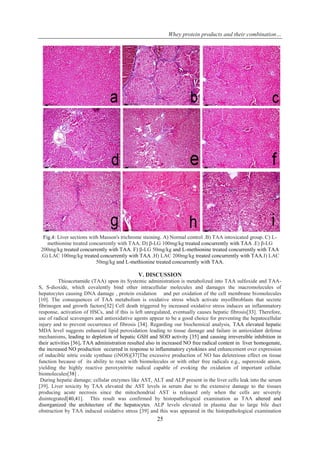 Whey protein products and their combination…
25
Fig.4: Liver sections with Masson's trichrome staining. A) Normal control .B) TAA intoxicated group. C) L-
methionine treated concurrently with TAA. D) β-LG 100mg/kg treated concurrently with TAA .E) β-LG
200mg/kg treated concurrently with TAA. F) β-LG 50mg/kg and L-methionine treated concurrently with TAA
.G) LAC 100mg/kg treated concurrently with TAA .H) LAC 200mg/kg treated concurrently with TAA.I) LAC
50mg/kg and L-methionine treated concurrently with TAA.
V. DISCUSSION
Thioacetamide (TAA) upon its Systemic administration is metabolized into TAA sulfoxide and TAA-
S, S-dioxide, which covalently bind other intracellular molecules and damages the macromolecules of
hepatocytes causing DNA damage , protein oxidation and per oxidation of the cell membrane biomolecules
[10]. The consequences of TAA metabolism is oxidative stress which activate myofibroblasts that secrete
fibrinogen and growth factors[32] Cell death triggered by increased oxidative stress induces an inflammatory
response, activation of HSCs, and if this is left unregulated, eventually causes hepatic fibrosis[33]. Therefore,
use of radical scavengers and antioxidative agents appear to be a good choice for preventing the hepatocellular
injury and to prevent occurrence of fibrosis [34]. Regarding our biochemical analysis, TAA elevated hepatic
MDA level suggests enhanced lipid peroxidation leading to tissue damage and failure in antioxidant defense
mechanisms, leading to depletion of hepatic GSH and SOD activity [35] and causing irreversible inhibition in
their activities [36]. TAA administration resulted also in increased NO free radical content in liver homogenate,
the increased NO production occurred in response to inflammatory cytokines and enhancement over expression
of inducible nitric oxide synthase (iNOS)[37]The excessive production of NO has deleterious effect on tissue
function because of its ability to react with biomolecules or with other free radicals e.g., superoxide anion,
yielding the highly reactive peroxynitrite radical capable of evoking the oxidation of important cellular
biomolecules[38] .
During hepatic damage; cellular enzymes like AST, ALT and ALP present in the liver cells leak into the serum
[39]. Liver toxicity by TAA elevated the AST levels in serum due to the extensive damage to the tissues
producing acute necrosis since the mitochondrial AST is released only when the cells are severely
disintegrated[40,41]. This result was confirmed by histopathological examination as TAA altered and
disorganized the architecture of the hepatocytes. ALP levels elevated in plasma due to large bile duct
obstruction by TAA induced oxidative stress [39] and this was appeared in the histopathological examination
 