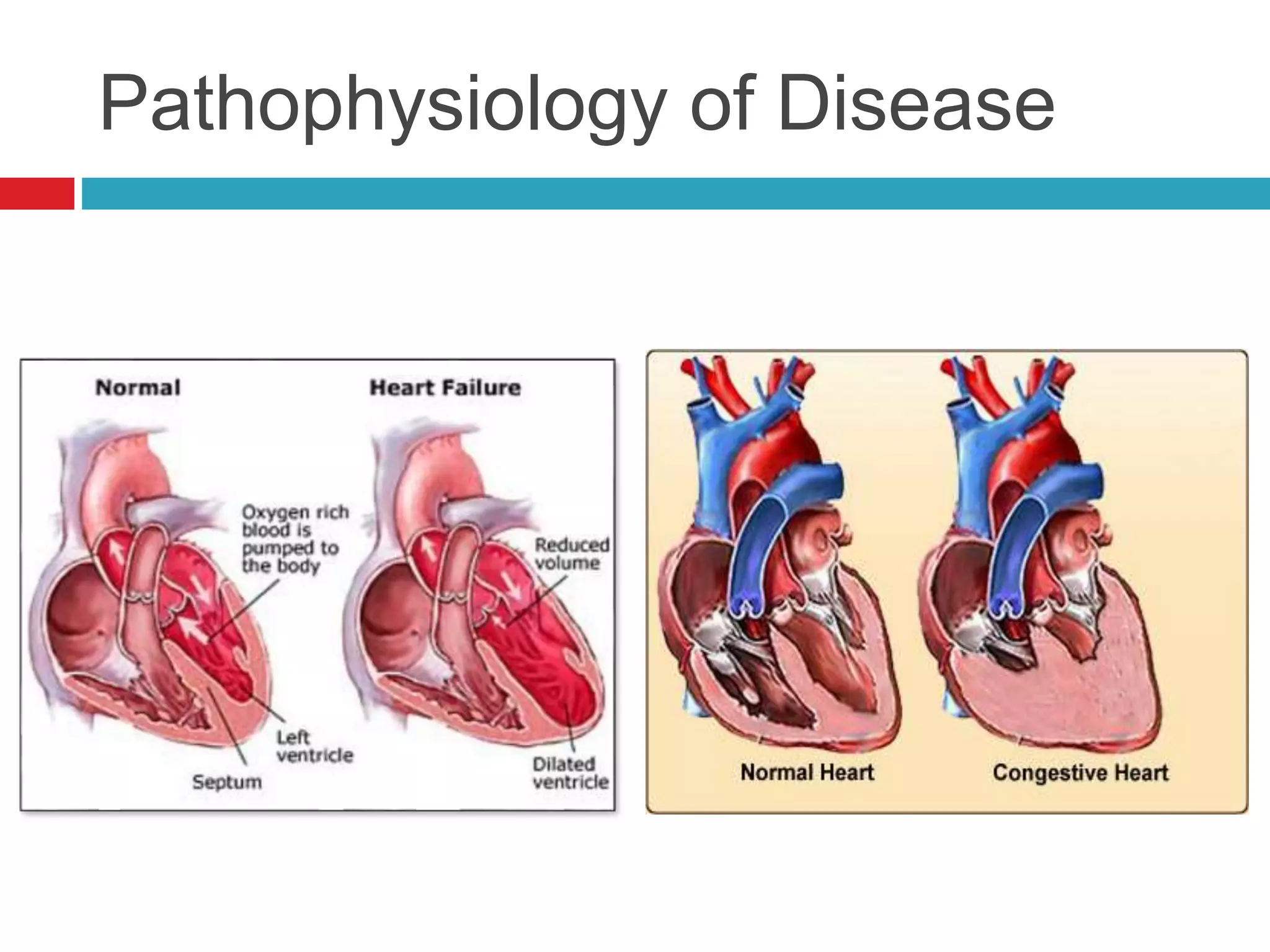 Pathophysiology of Disease
 