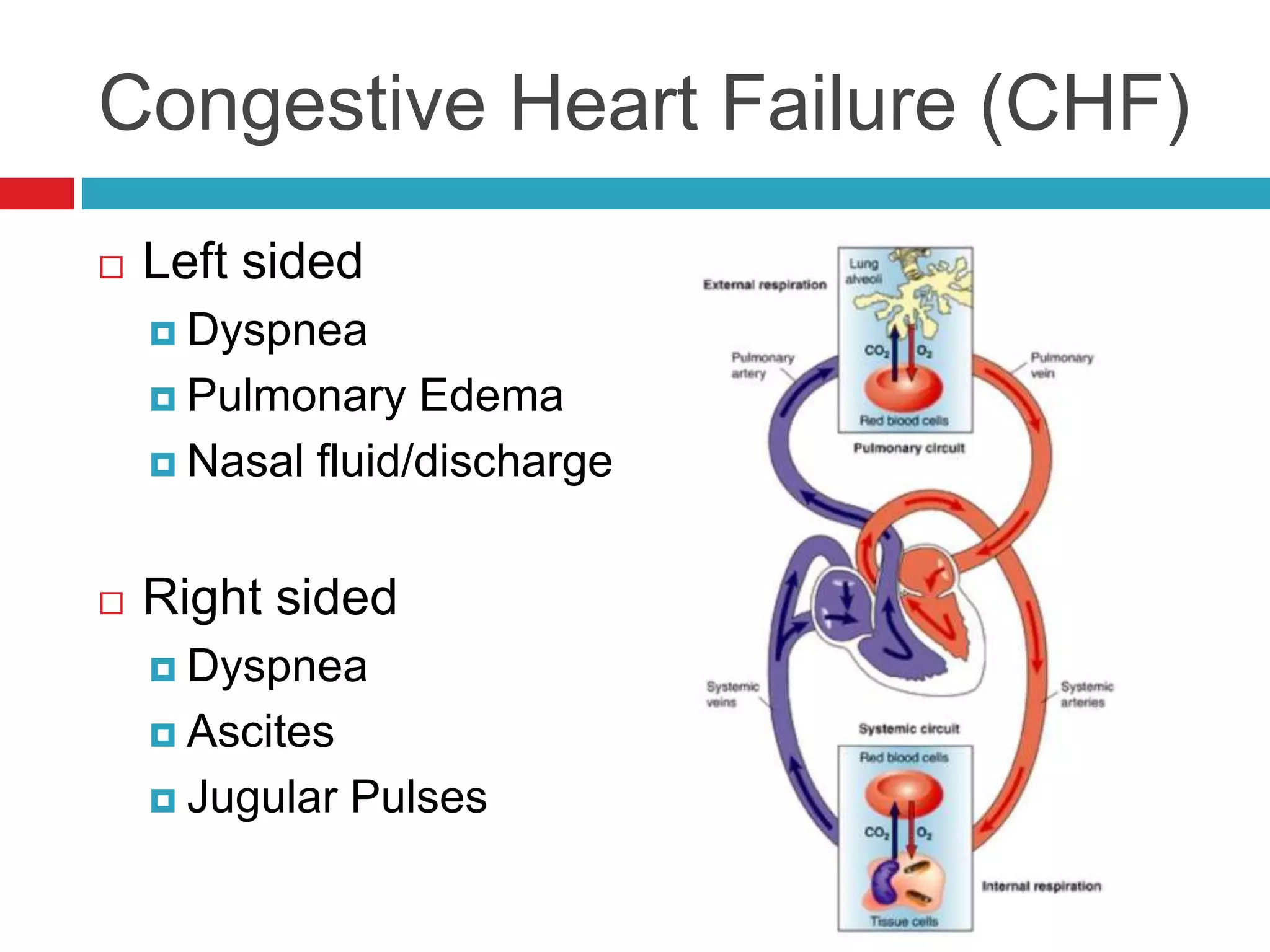 Congestive Heart Failure (CHF)
 Left sided
 Dyspnea
 Pulmonary Edema
 Nasal fluid/discharge
 Right sided
 Dyspnea
 Ascites
 Jugular Pulses
 