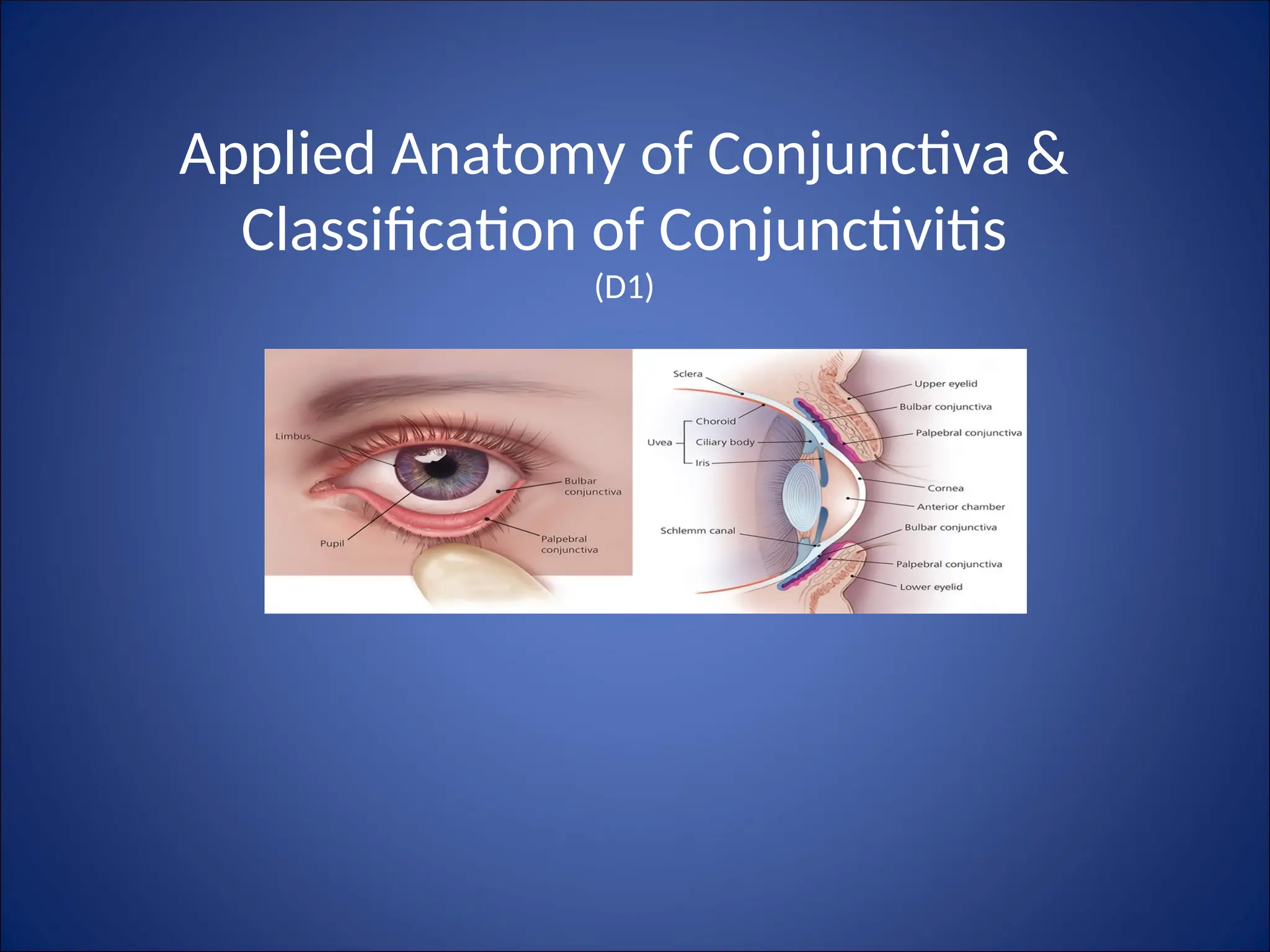 Conjoctive D1 - Applied Anatomy of Conjunctiva & Classification of Conjunctivitis.ppt
