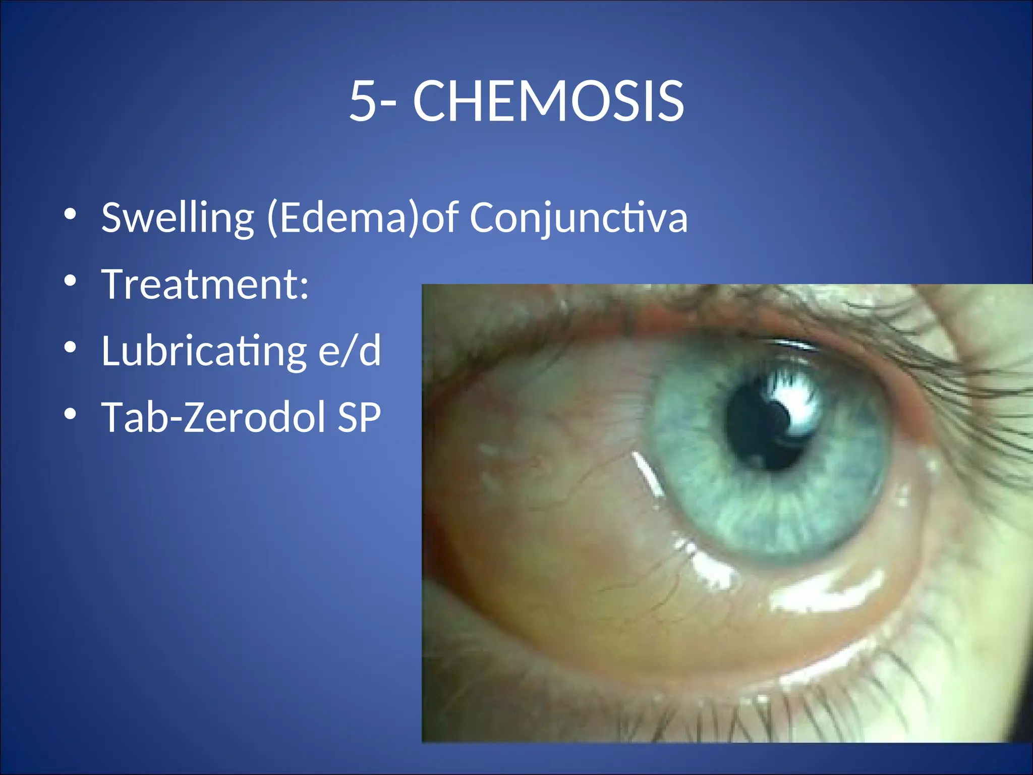D1 - Applied Anatomy of Conjunctiva & Classification of Conjunctivitis.ppt