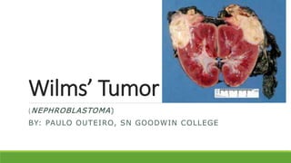 Wilms’ Tumor
(NEPHROBLASTOMA)
BY: PAULO OUTEIRO, SN GOODWIN COLLEGE
 