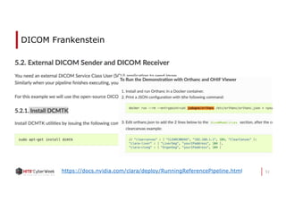 51
DICOM Frankenstein
https://docs.nvidia.com/clara/deploy/RunningReferencePipeline.html
 