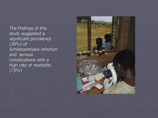 The findings of this study suggested a significant prevalence (30%) of Schistosomiasis infection and  serious complications with a high rate of morbidity (73%)  