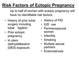 ECTOPIC PREGNANCY | PPTX