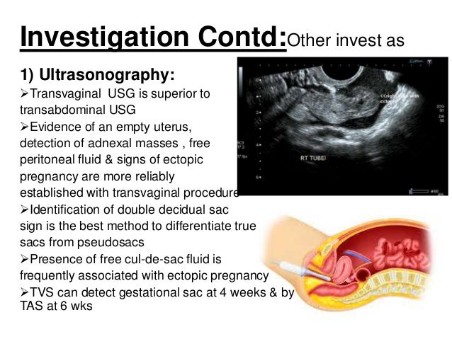 Download Adnexal Regions Background