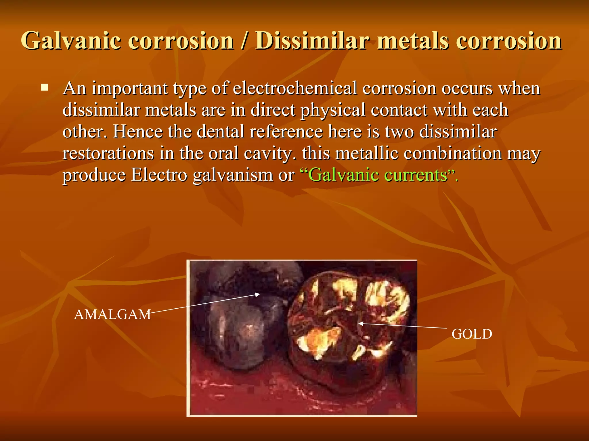 Galvanic corrosion / Dissimilar metals corrosion  An important type of electrochemical corrosion occurs when dissimilar metals are in direct physical contact with each other. Hence the dental reference here is two dissimilar restorations in the oral cavity. this metallic combination may produce Electro galvanism or  “Galvanic currents ”. AMALGAM GOLD 