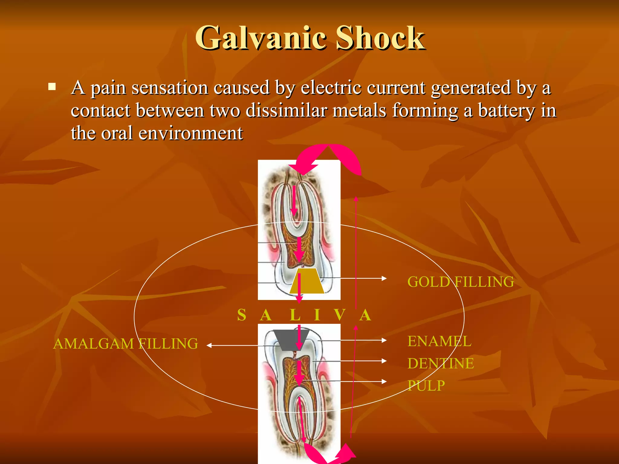 Galvanic Shock A pain sensation caused by electric current generated by a contact between two dissimilar metals forming a battery in the oral environment GOLD FILLING ENAMEL DENTINE PULP AMALGAM FILLING S  A  L  I  V  A 