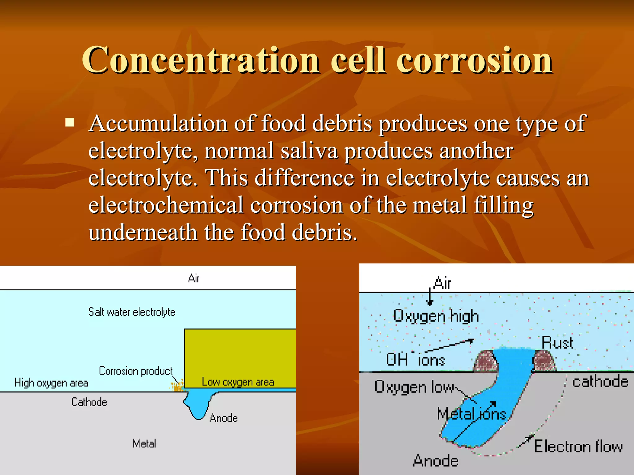 Concentration cell corrosion Accumulation of food debris produces one type of electrolyte, normal saliva produces another electrolyte. This difference in electrolyte causes an electrochemical corrosion of the metal filling underneath the food debris. 