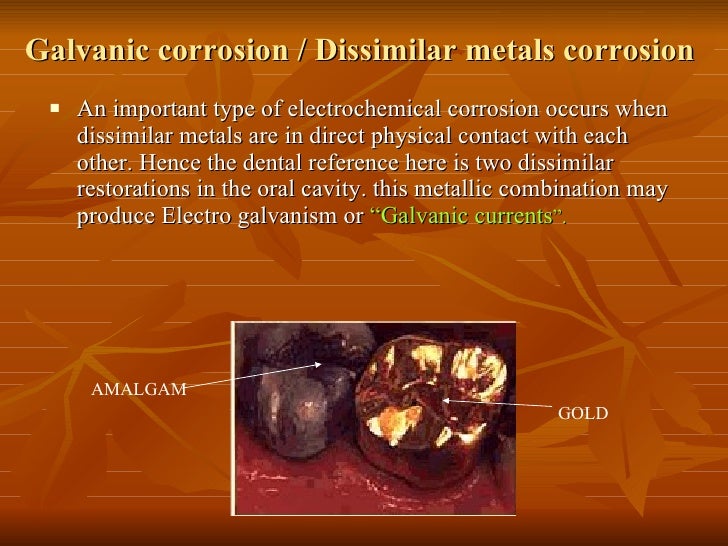 Tarnish and Corrosion in Dentistry