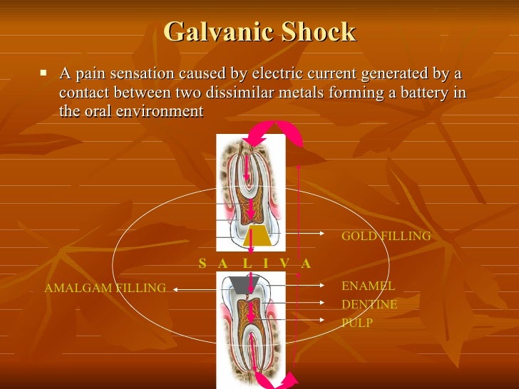 Tarnish and Corrosion in Dentistry