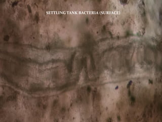 SETTLING TANK BACTERIA (SURFACE)
 