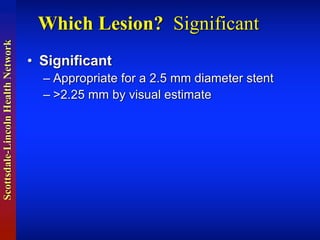 Scottsdale-LincolnHealthNetwork
Which Lesion? Significant
• Significant
– Appropriate  for  a  2.5  mm  diameter  stent
– >2.25  mm  by  visual  estimate
 