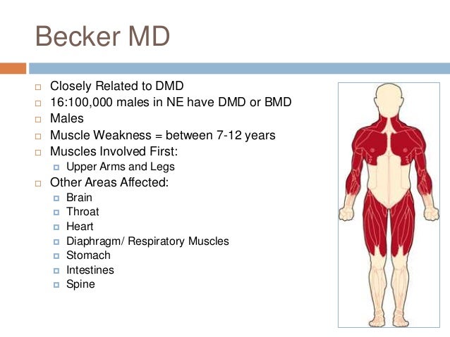 Muscular Dystrophy Presentation (Final)