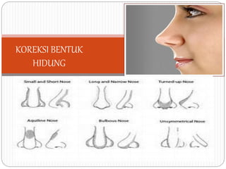 KOREKSI BENTUK
HIDUNG
 