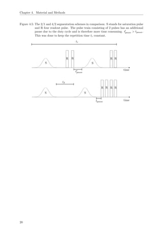 Chapter 4. Material and Methods
Figure 4.5: The 2/1 and 4/2 segmentation schemes in comparison: S stands for saturation pulse
and R four readout pulse. The pulse train consisting of 2 pulses has an additional
pause due to the duty cycle and is therefore more time consuming. tpause > tpause.
This was done to keep the repetition time tr constant.
td
time
time
tpause
tpause
tr
S S
S S
R R R R
R R R R
20
 