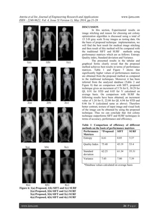 Amrita et al Int. Journal of Engineering Research and Applications www.ijera.com
ISSN : 2248-9622, Vol. 4, Issue 5( Version 1), May 2014, pp.21-28
www.ijera.com 26 | P a g e
1(a) 1(b) 1(c)
2(a) 2(b) 2(c)
3(a) 3(b) 3(c)
4(a) 4(b) 4(c)
Figure 6: 1(a) Proposed, 1(b) SIFT and 1(c) SURF
2(a) Proposed, 2(b) SIFT and 1(c) SURF
3(a) Proposed, 3(b) SIFT and 3(c) SURF
4(a) Proposed, 4(b) SIFT and 4(c) SURF
DISCUSSION
In this section, Experimental results on
image stitching and reason for choosing ant colony
optimization algorithm is discussed using a total of
15 2-D gray scale X-ray images as testing data. On
the basis of proposed technique implementation, we
will find the best result for medical image stitching
and then result of this method will be compared with
the traditional SIFT and SURF methods using
performance matrices which are as follows: Entropy
Quality index, Standard deviation and Variance.
The presented results in the tabular and
graphical forms clearly reveal that the proposed
method achieves best results in terms of performance
matrices. Table 1 and Figure 7 shows that
significantly higher values of performances matrices
are obtained from the proposed method as compared
to the traditional techniques. Moreover it has been
inferred from the analyzed database (Table 2 and
Figure 8) that on comparison with SIFT, proposed
technique gives an increment of 5.76 for E, 30.29 for
QI, 0.91 for STD and 0.05 for V calculated on
average basis. On comparison with SURF the
following results have been obtained, an increment
value of 1.24 for E, 22.08 for QI, 6.94 for STD and
0.46 for V (calculated same as above). Therefore
better contrast, texture of input image and visual look
of the image can be obtained by using the proposed
technique. Thus we can conclude that Ant colony
technique outperforms SIFT and SURF techniques in
terms of accuracy, performance and efficiency.
Table 1: Comparison of efficiency of different
methods on the basis of performance matrices
Performance
Matrices
*Proposed SIFT SURF
Entropy 6.61 0.85 5.37
Quality Index 75.48 45.19 53.4
Standard
deviation
62.25 61.34 55.31
Variance 7.85 7.80 7.39
*Database values calculated on average basis
 