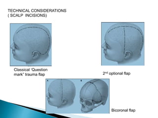Old Reverse Question Mark Incision Neurotrauma | PPTX