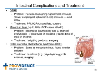 Intestinal Complications and Treatment
• GERD
– Problem: Persistent coughing ↑abdominal pressure
↑lower esophageal sphincter (LES) pressure → acid
reflux
– Treatment: PPI, H2RA, sucralfate, surgery
• Meconium ileus (up to 20% of CF cases at birth)
– Problem: pancreatic insufficiency and Cl channel
dysfunction → thick fluids in intestine ↓ transit time of
stool in children
– Treatment: Irrigating products, surgery
• Distal interstitial obstructional syndrome (DIOS)
– Problem: Same as meconium ileus, found in older
children
– Treatment: laxatives (e.g. polyethylene glycol),
enemas, surgery
23
 