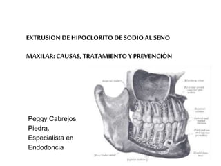 EXTRUSION DE HIPOCLORITO DE SODIO AL SENO
MAXILAR:CAUSAS, TRATAMIENTO Y PREVENCIÓN
Peggy Cabrejos
Piedra.
Especialista en
Endodoncia
 