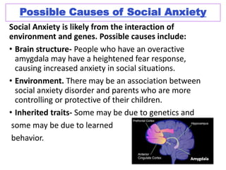 SOCIAL ANXIETY THERAPY SANTA BARBARA - National Social Anxiety Center