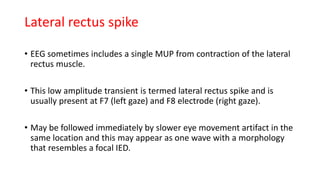 EMG artifact presentation | PPTX