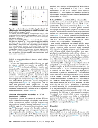 MG262 or epoxomicin (data not shown), which stabilize
PINK1 in vitro.56,57
In lower and higher eukaryotes, knocking out Lon leads
to reduced mtDNA copy-number or mtDNA dele-
tions.22,23,58,59
We performed mtDNA copy-number anal-
ysis and mtDNA sequencing by using total genomic DNA
isolated from peripheral blood lymphocytes obtained
from three homozygous p.Arg721Gly probands and their
unaffected heterozygous parents. Quantitative PCR
showed no consistent difference of mtDNA copy number
between probands and parents (Figure 5B). Similar results
were obtained with genomic DNA isolated from proband
and parental LCLs (Figure S5). Using genomic DNA iso-
lated from peripheral blood lymphocytes for deep
sequencing of mtDNA exposed no deletions or signiﬁcant
differences between mtDNA sequences of each proband
and that individual’s mother (Table S1).
Abnormal Mitochondrial Morphology in CODAS
Lymphoblast Cell Lines
Transmission electron microscopy of proband LCLs re-
vealed enlarged mitochondria with swollen intra- or inter-
cristal compartments, uniform vesicular structures, and
electron-dense intramitochondrial inclusions (Figures 6A
and 6C), suggestive of abnormal inner-membrane topol-
ogy.60,61
By contrast, parental LCLs showed typical mito-
chondrial morphology with well-organized cristae and
only occasional swollen cristal spaces (Figures 6B and 6D,
and S6). Approximately 43 5 3.4% (SEM) of mitochondria
(n ¼ 59) examined from two CODAS probands displayed
abnormal mitochondrial morphology (p  0.001), whereas
only 5.2 5 3.7% of paternal (n ¼ 48), 14.1 5 3.3% of
maternal (n ¼ 63), and 10.6 5 5.1% (n ¼ 326) of homozy-
gous-normal LCL mitochondria were abnormal. There was
no signiﬁcant difference between maternal and paternal
mitochondria (p ¼ 0.232).
Reduced MT-CO2 and SRC in CODAS Mitochondria
Lon has been shown to mediate protein quality control
and remodeling of cytochrome c oxidase, which is com-
plex IV of the mitochondrial respiratory chain.16,17,21
We
examined the abundance of various protein subunits
belonging to respiratory chain complexes I-V and detected
a speciﬁc and substantial reduction of mtDNA-encoded
subunit II of cytochrome c oxidase (MT-CO2) in proband
cells (Figure 7A). In contrast, proband and parental LCLs
had similar abundances of other mtDNA-encoded (MT-
CYB, MT-CO1) and nuclear-encoded (NDUFB8, SDHB,
UQCRC2, ATP5A1) respiratory chain subunits.
One possible explanation for reduced MT-CO2 abun-
dance in CODAS cell lines was its poor solubility in the
protein extraction buffer employed, which contained
0.5% Triton X-100. To address this, we used cell-lysis buffer
with 8 M urea, which effectively solubilizes most aggre-
gated proteins and inclusion bodies. When cells were ex-
tracted with this strong denaturant, similar abundances
of MT-CO2 were observed in proband and parental LCLs.
Urea did not alter solubility of other mtDNA- or nuclear-
encoded respiratory-chain subunits (Figure 7A).
Insolubility of MT-CO2 might be caused by the failure of
p.Arg721Gly to properly degrade and/or assemble this sub-
unit into complex IV. To determine whether MT-CO2 is a
natural substrate of Lon, we knocked down the protease
in different cell lines. MT-CO2 is highly hydrophobic
and difﬁcult to purify; we therefore used a cellular system
rather than directly testing puriﬁed Lon activity against
that of MT-CO2. Inducible or transient knockdown of
Lon was associated with increased MT-CO2 abundance in
HeLa, HEK293T, and PC3 cells (Figure 7B). Taken together,
these results suggest that MT-CO2 is a natural Lon sub-
strate, and that p.Arg721Gly’s failure either to degrade or
to properly assemble this protein in CODAS cells results
in its aggregation within mitochondria.
After observing the reduced solubility of MT-CO2, we
investigated the efﬁciency of mitochondrial respiration.
Normalized basal mitochondrial oxygen consumption
and ATP-linked respiration were similar in proband and
parental cells, but CODAS cells had signiﬁcantly lower
SRC when mitochondrial membrane potential was dissi-
pated by the uncoupler FCCP (Figure 7C).
Discussion
Pathophysiology of CODAS Syndrome
Mitochondrial Lon is a multi-functional enzyme with
diverse roles that include (1) elimination of misfolded and
oxidatively damaged proteins,12–14,20,62
(2) selective
Figure 5. Lon Protein Levels and mtDNA Copy Numbers in CO-
DAS-Syndrome-Affected Probands Are Similar to Those of Their
Unaffected Heterozygous Parents
(A) Proteins were extracted from LCLs generated from CODAS-
syndrome-affected probands and their parents. Triton X-100 lysis
buffer was used, and 40 mg of the extract was immunoblotted for
the proteins as shown.
(B) Quantitative PCR (qPCR) was performed so that the relative
mtDNA copy number in CODAS-syndrome-affected probands
and their respective mothers and fathers could be determined
with genomic DNA isolated from the peripheral blood lympho-
cytes from the family members as shown. qPCR was performed
with Taqman probes and primers for the mtDNA-encoded MT-
CYB gene and the nuclear DNA-encoded APP gene as a reference.
The relative quantity of mtDNA copy number was calculated by
the DDCt method. Error bars represent the maximum and mini-
mum relative quantitation.
130 The American Journal of Human Genetics 96, 121–135, January 8, 2015
 