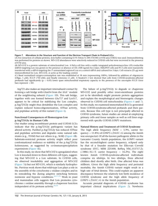Arg721 also makes an important intersubunit contact by
forming a salt bridge with Glu654 from the AAAþ
module
of the neighboring subunit (Figure 3D). This salt bridge,
together with one formed between Glu717 and Lys517,
appears to be critical for stabilizing the Lon complex.
p.Arg721Gly might thus destabilize the Lon complex and
explain reduced homo-oligomerization, ATPase activity,
and peptidase activity of this variant (Figure 4).
Functional Consequences of Homozygous Lon
p.Arg721Gly in Human Cells
Our studies using recombinant protein and CODAS LCLs
indicate that the p.Arg721Gly pathogenic variant has
altered activity. Puriﬁed p.Arg721Gly has reduced ATPase
and peptidase activities and degrades some natural sub-
strates (e.g., TFAM) but not others (e.g., StAR) (Figure 4B).
Substrate-restricted protease activity might reﬂect poor
conformational resilience or stability of the p.Arg721Gly
holoenzyme, as suggested by co-immunoprecipitation
experiments (Figure 4E).
In this study, we show that MT-CO2 is upregulated when
Lon is knocked down in three different cell types, suggest-
ing that MT-CO2 is a Lon substrate. In CODAS cells,
we observed insolubility and aggregation of MT-CO2
(Figure 7A) but not MT-CO1, which is similarly hydropho-
bic. Previous work shows that wild-type Lon plays a role in
the assembly of the cytochrome c oxidase complex and in
its remodeling the during adaptive switching between
normoxic and hypoxic conditions.16,17,21
Work in yeast
and mammalian cells suggests that Lon promotes cyto-
chrome c oxidase assembly through a chaperone function
independent of its protease activity.16,21
The failure of p.Arg721Gly to degrade or chaperone
MT-CO2 (and possibly other inner-membrane proteins
yet to be identiﬁed) might promote protein aggregation
and explain the morphological and bioenergetic changes
observed in CODAS cell mitochondria (Figures 6 and 7).
In this study, we examined immortalized B-LCLs generated
from CODAS-syndrome-affected probands and their par-
ents. Because this cell type is not principally affected in
CODAS syndrome, future studies are aimed at employing
primary cells and tissue samples as well as cell lines engi-
neered with speciﬁc CODAS LONP1 mutations.
Natural History and Treatment of CODAS Syndrome
The high allele frequency (MAF ¼ 5.9%, carrier fre-
quency ¼ 11.8%) of LONP1 c.2161CG among the Amish
was unexpected. Of all the known pathogenic alleles in the
Lancaster County Amish population, the LONP1 variant
has the second-highest carrier frequency, eclipsed only
by that of a founder mutation for Ellis-van Creveld
syndrome (EVC; MIM 225500; RefSeq NM_153717.2);
c.1886þ5GT; carrier frequency ¼ 16.2%). The eight
known Amish CODAS-syndrome-affected individuals
comprise six sibships. In two sibships, three affected
children died shortly after birth. One affected fetus was
stillborn. Given the high allele frequency and perinatal
mortality, the Amish CODAS variant might result in a
high rate of fetal demise. This could explain an apparent
discrepancy between the relatively low birth incidence of
CODAS syndrome and the high allele frequency of
LONP1 c.2161CG in the Amish population.
Accurate prenatal diagnosis of CODAS syndrome has
important clinical implications (Figure 2). Newborns
Figure 7. Alterations in the Structure and Function of the Electron Transport Chain in Proband LCLs
(A) For extraction of cellular proteins, lysis buffer containing 0.1% Triton X-100 (TX100) or 8 M urea (UREA) was used. Immunoblotting
was performed for proteins as shown. MT-CO2 abundances were selectively reduced in CODAS cells but were recovered in the presence
of 8 M urea.
(B) MT-CO2 is a protein substrate of mitochondrial Lon. A HeLa cell line with a stably integrated anhydrotetracycline (ATc)-inducible
shRNA targeting Lon was grown in the presence or absence of ATc (500 ng/ml) for 4 days. HEK293T cells and PC3 cells were transiently
transfected with a siRNA targeting the 30
untranslated regionof Lon or a control siRNA and cultured for 3 days. Cell extracts (25 mg) were
immunoblotted for Lon, MT-CO2, or actin as the loading control.
(C) Basal normalized oxygen-consumption rate was established at 18 min (representing 100%), followed by addition of oligomycin
(Oligo, 1 mM); FCCP (750 nM); and ﬁnally rotenone (1 mM). A Student’s t test showed that cells from CODAS-syndrome-affected
probands had signiﬁcantly (p  0.05) lower spare mitochondrial respiratory capacity in the presence of the uncoupler FCCP. Error
bars represent 5SD.
132 The American Journal of Human Genetics 96, 121–135, January 8, 2015
 